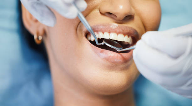 Best Broken or Chipped Tooth Repair in Bayou Country Clu, LA